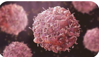 Cancer surveillance: Experts urge Nigeria to Prioritize Data-driven approach